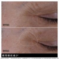 「双萃精华眼霜」武汉冬对上吖商贸有限公司双萃眼部焕亮精华